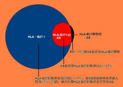 怀疑是强直检查hla-b27可以吗?